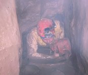 31a Colostomy crawl resized.jpg
