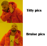 bruise pics.png